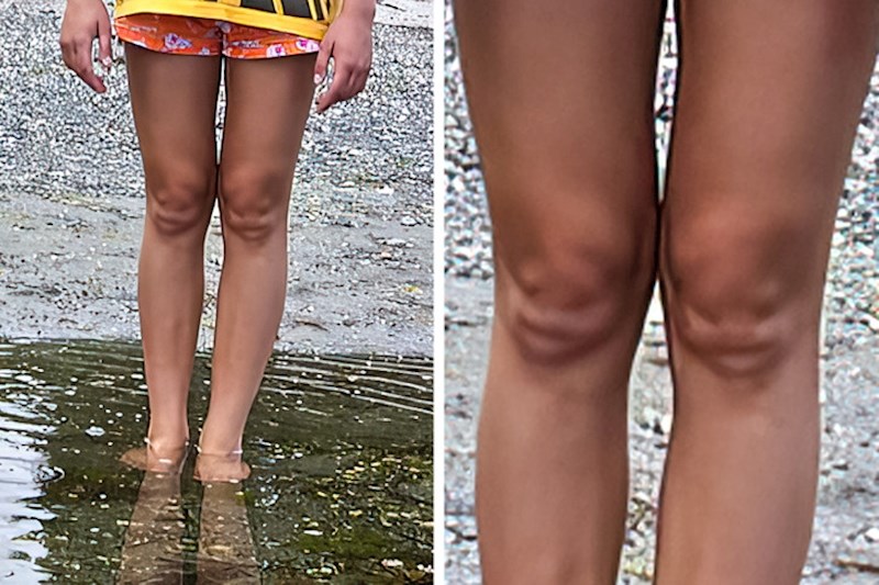 1. Moja nećakinja ima jako neobična koljena