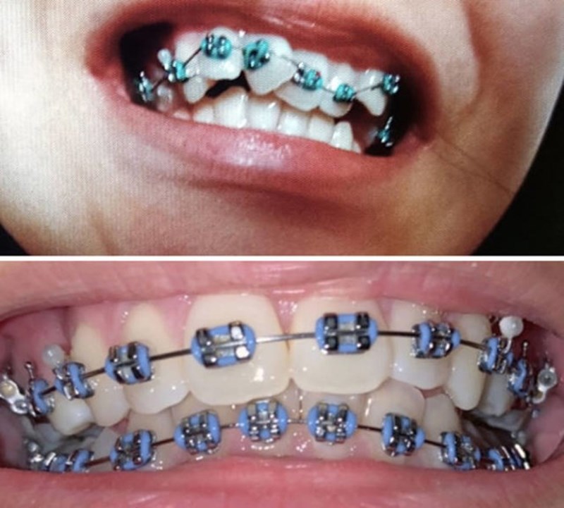 17. Moć ortodoncije