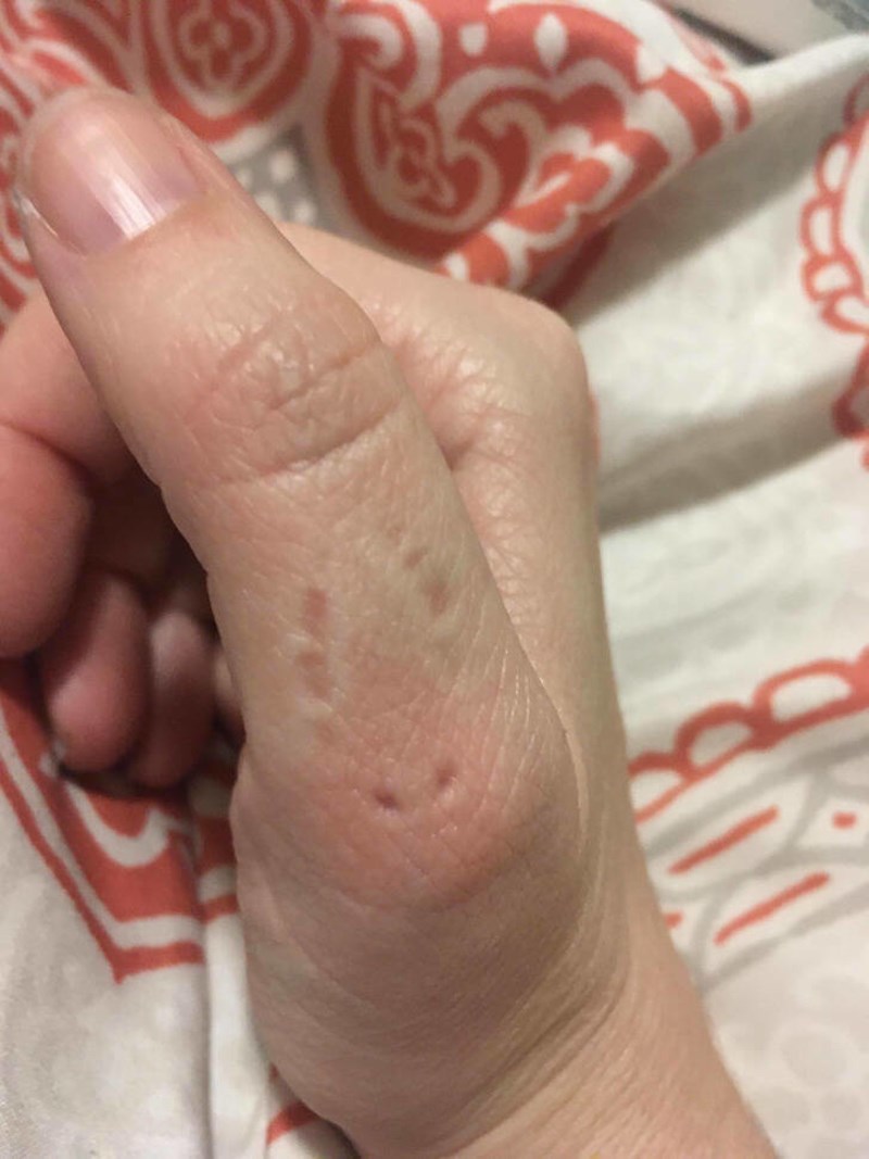 2. Moj trogodišnjak me svom snagom ugrizao