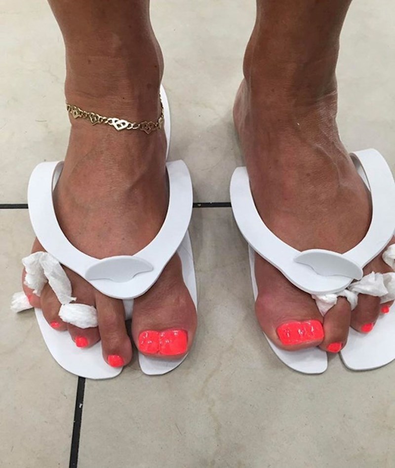 "Moja prijateljica ima duple nožne palčeve."