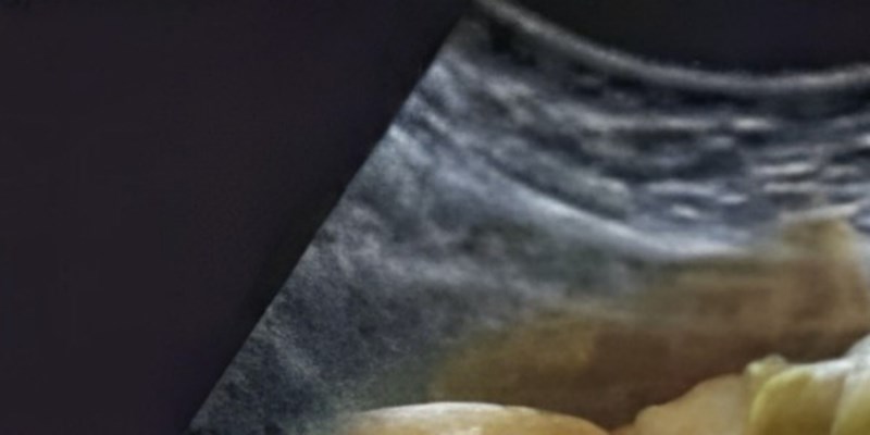 Fora pokazuje kako ovih dana izgleda unutrašnjost želuca prosječnog Balkanca, urnebesna je