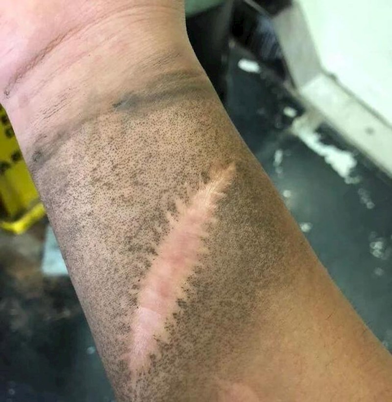 13. Moj ožiljak nikad se ne zmaže na poslu