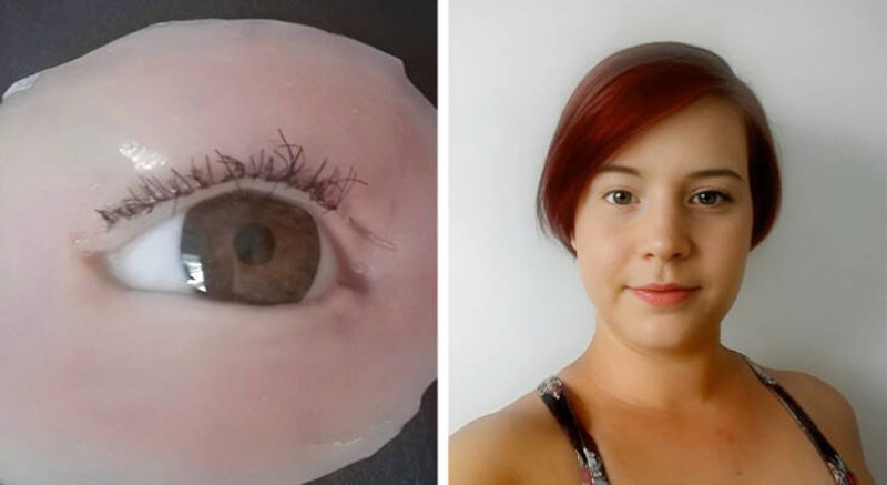 3. Ako niste znali, postoji i očna proteza i ovako izgleda