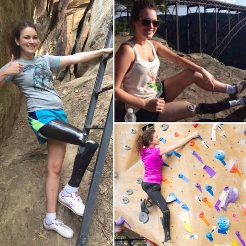 1. Prije 15 godina izgubila je nogu, ali to ju nije spriječilo da živi svoj život punim plućima