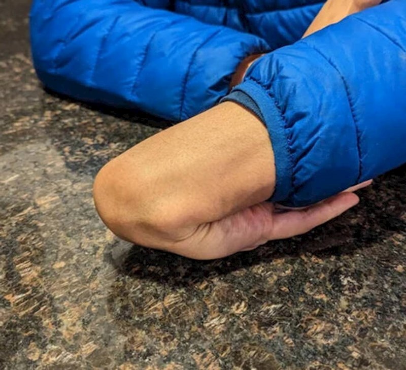 16. Netko ima ekstremno savitljivu šaku