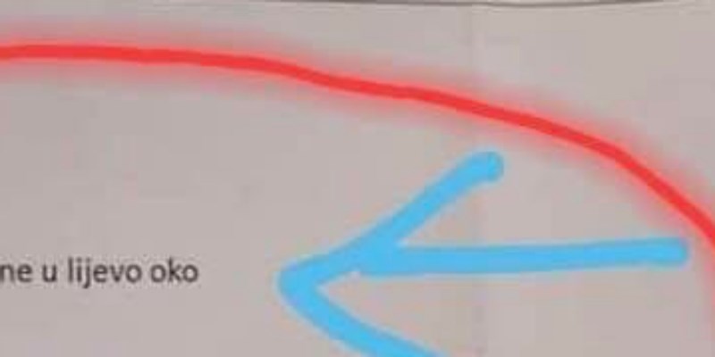 Nalaz ovog tipa izazvao je salve smijeha u cijeloj zemlji, morate vidjeti zašto je došao na pregled