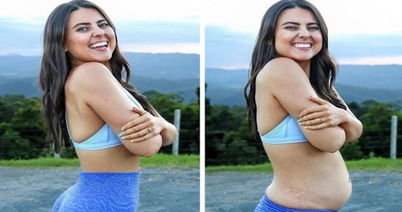 Ova žena objavljuje fotke u ne baš laskavim pozama i pomaže ljudima da prihvate svoje nesavršenosti