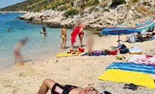 Tip je na plaži zaštitio glavu od sunca na nesvakidašnji način i postao viralni hit, morate vidjeti