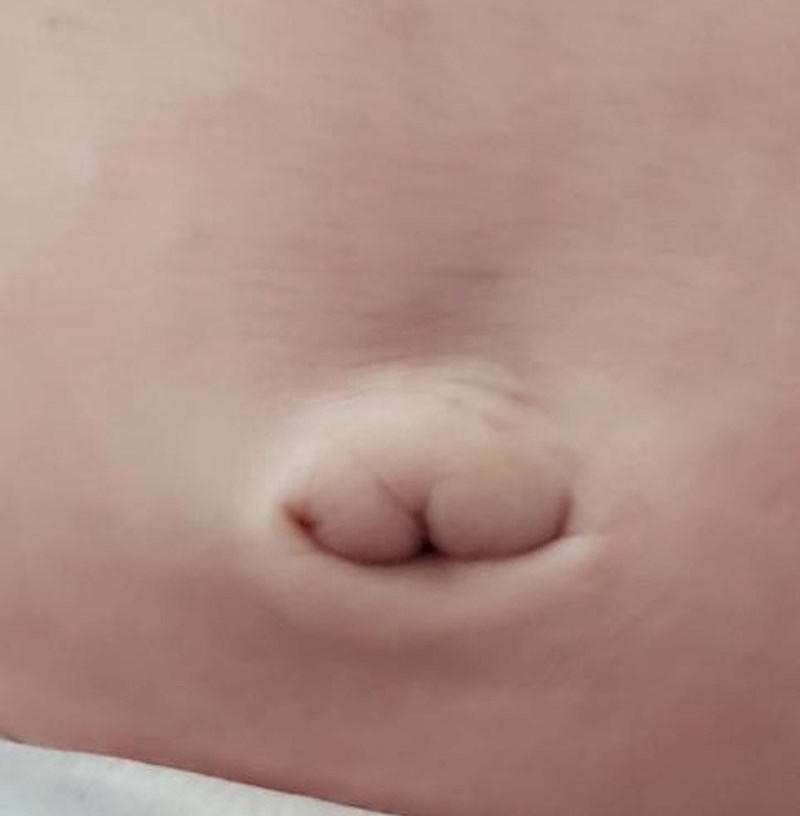 12. Pupak moga sina izgleda kao guza!