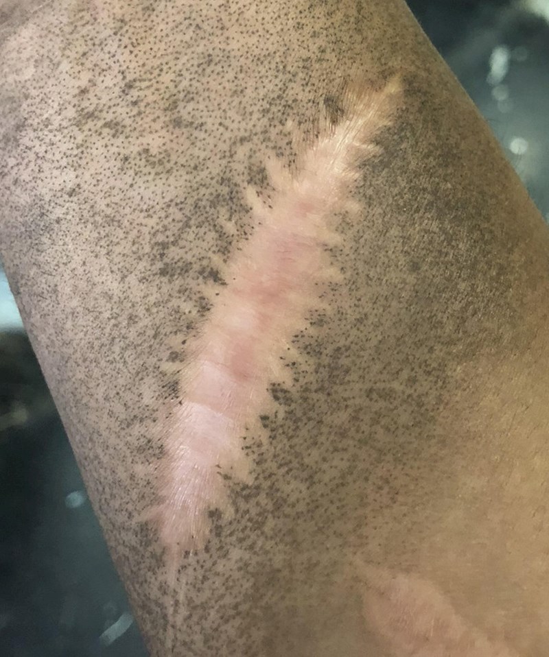 19. Moj ožiljak ne može se zaprljati