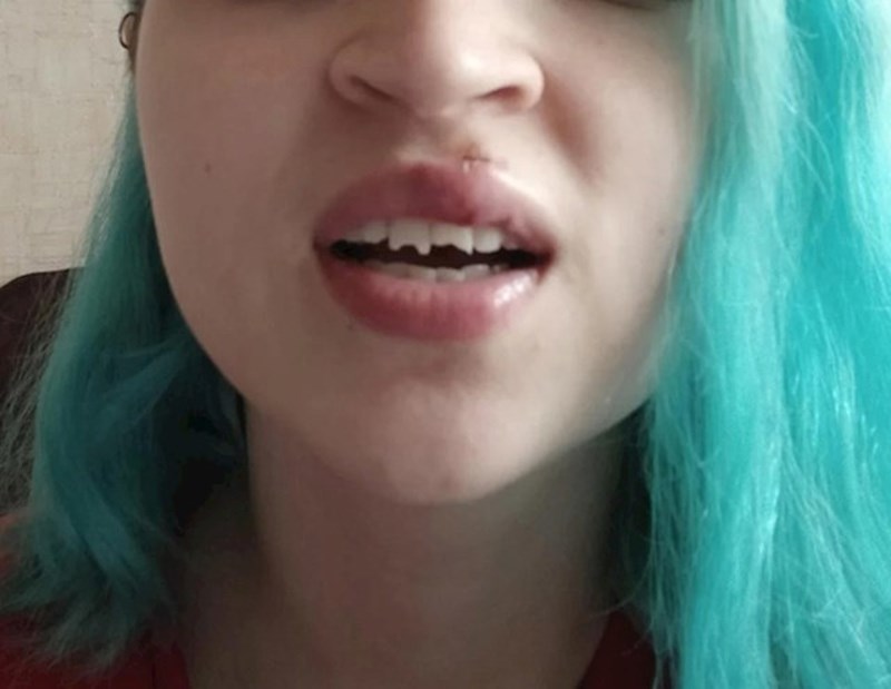 Dogodila mi se noćna mora! Pala sam zubima točno na asfalt!