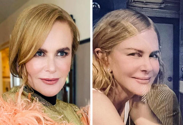 Nicole Kidman