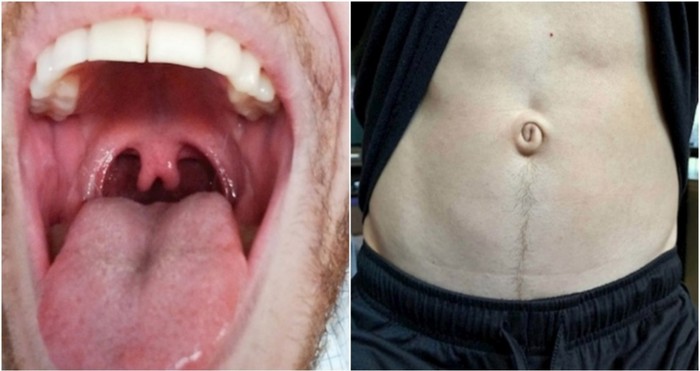 17 puta kad se priroda malo poigrala s fizičkim karakteristikama ljudi