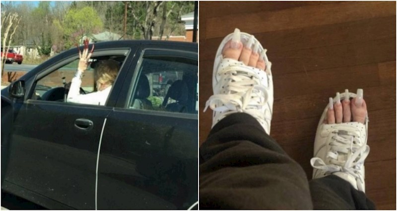 17 ekstremno bizarnih prizora koje je nemoguće gledati bez da se zgrozite