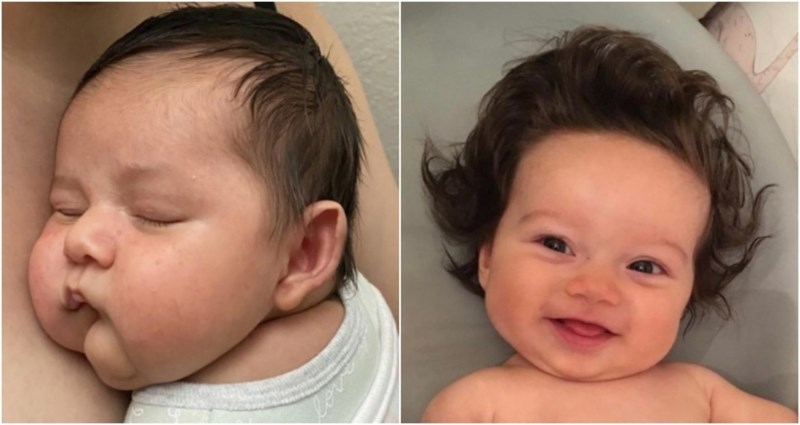 15 beba s jedinstvenim fizičkim osobinama zbog kojih plijene pažnju gdje god se pojave