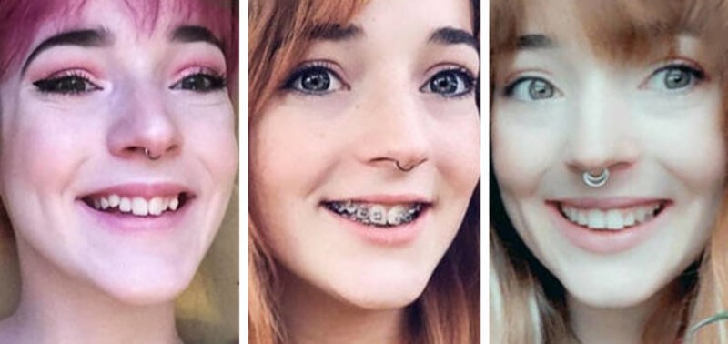 6. Ispravila sam zube