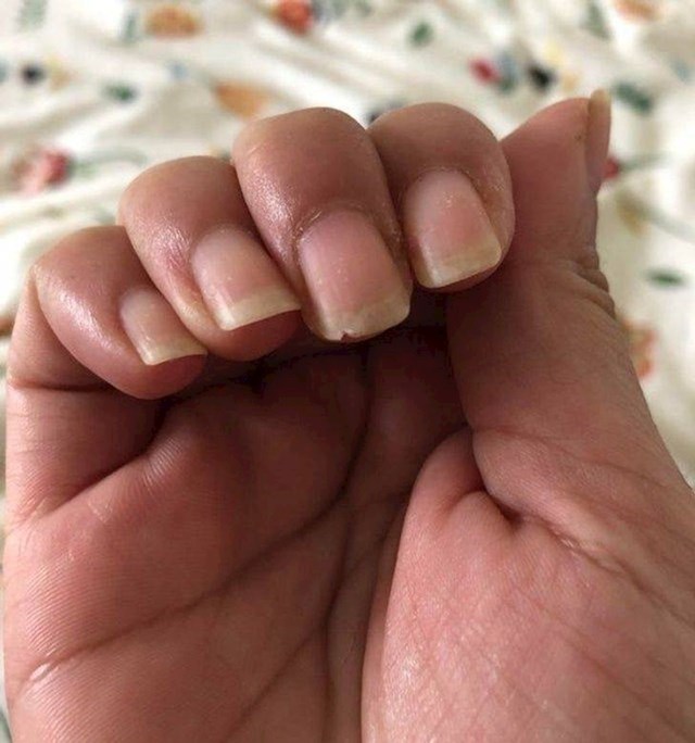 3. Svaka žena mrzi ovu situaciju - kad vam se odlomi dio nokta i zapinje za baš sve što primite 😫