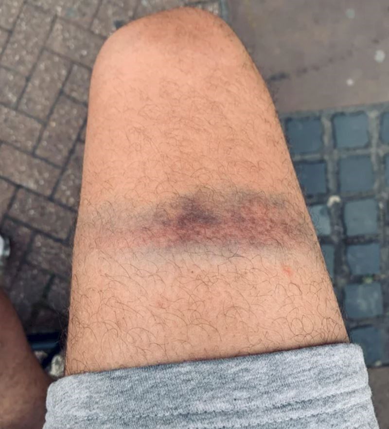 10. Trčao sam livadom za psom, kad me odjednom žica koju je netko postavio usred trave spriječila u tome