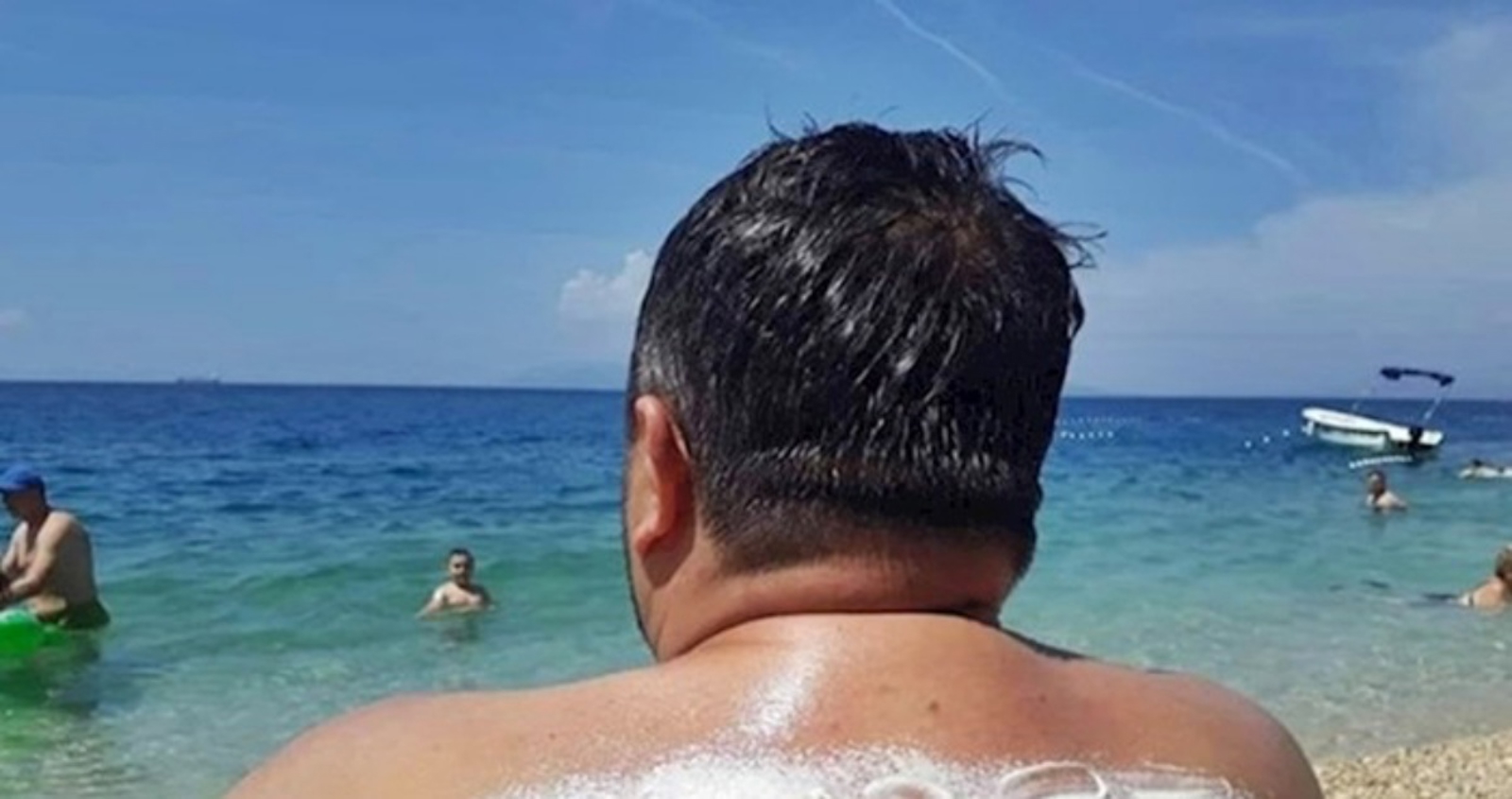 Žena je namazala muža kremom za sunčanje, morate vidjeti kakvo mu je iznenađenje ostavila na leđima
