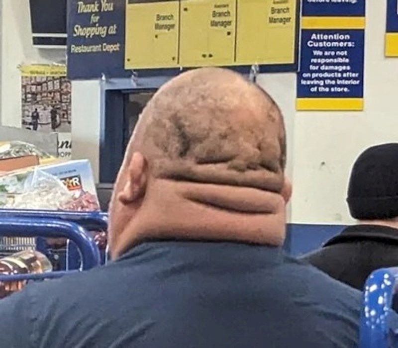 5. Kao da mu drugo biće živi sa stražnje strane glave 🤣