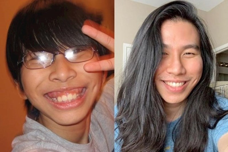 6. Moj osmijeh kad sam bio klinac i danas