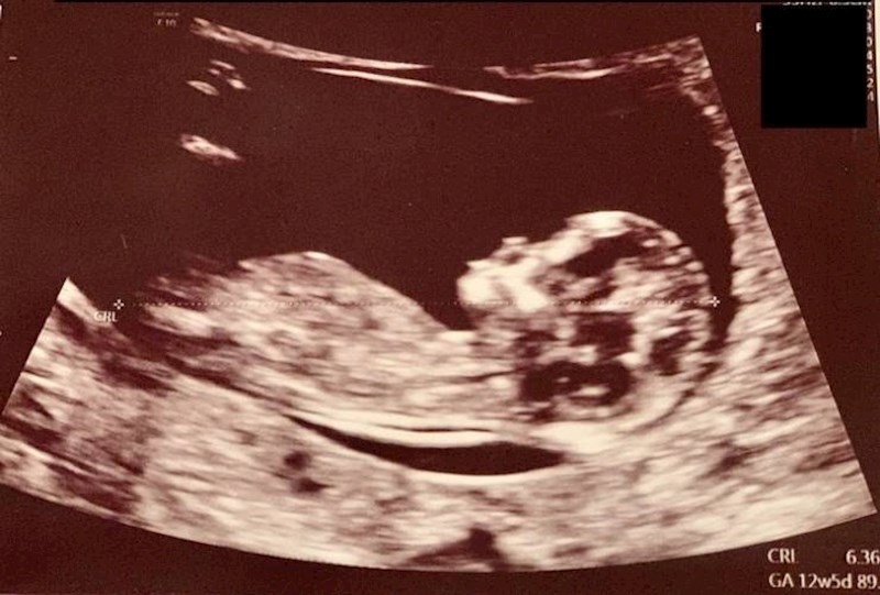 15. Žena i ja godinama smo čekali na ovu snimku!!❤️