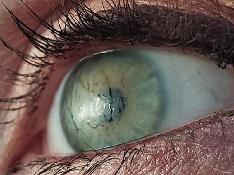 4. Mojoj ženi se oči zamagle nakon dugog tuširanja