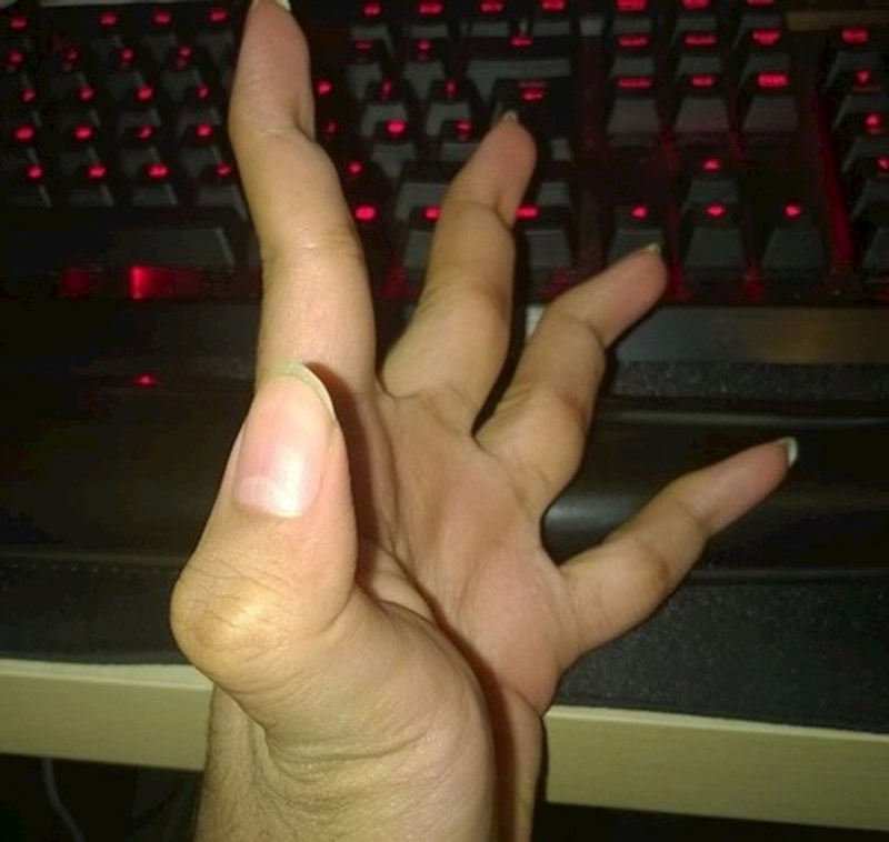 Vrlo neobični zglobovi