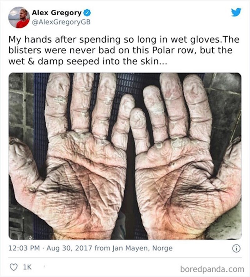 Noge biciklista nakon utrke