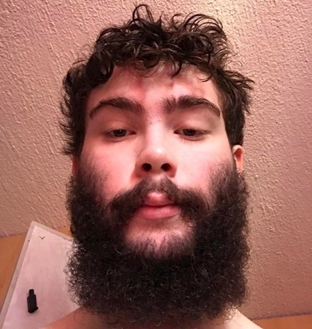 Imam 17 godina i prvi put puštam bradu