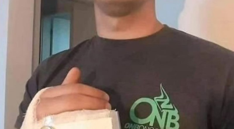 Tip je slomio prst, milijuni umiru od smijeha zbog onog što sad mora nositi na ruci