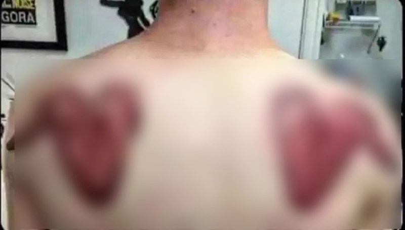 Tip je poželio tetovirati krila na leđima, teško je riječima opisati ono što je dobio