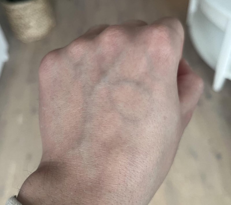 Žile na mojoj ruci ispisuju riječ YO