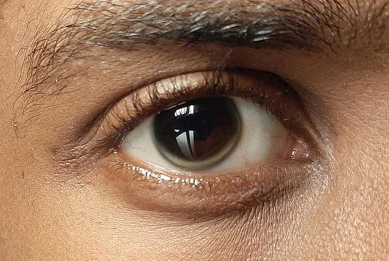Ima vrlo neobično oko