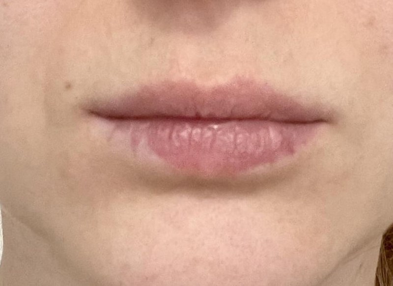 Dio usana nema pigment