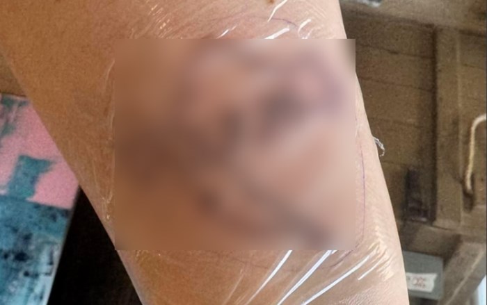 Djevojka je napravila tetovažu u čast koncertu Thompsona, pogledajte što će zauvijek nositi na ruci