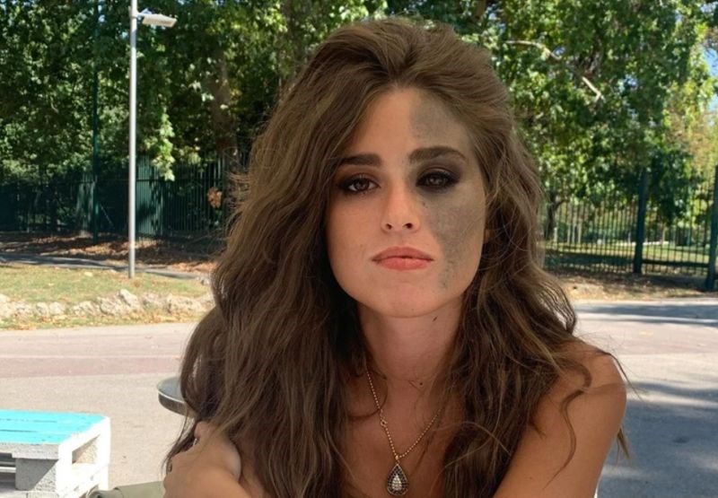 Tinejdžerske godine provela je skrivajući svoju posebnost šminkom