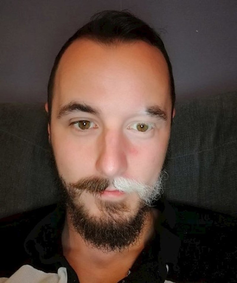 Ovaj lik ima i tamne i bijele dlake na licu