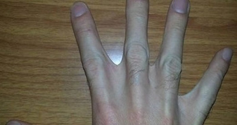 12 ljudi s fizičkim osobinama koje se definitivno ne viđaju svaki dan