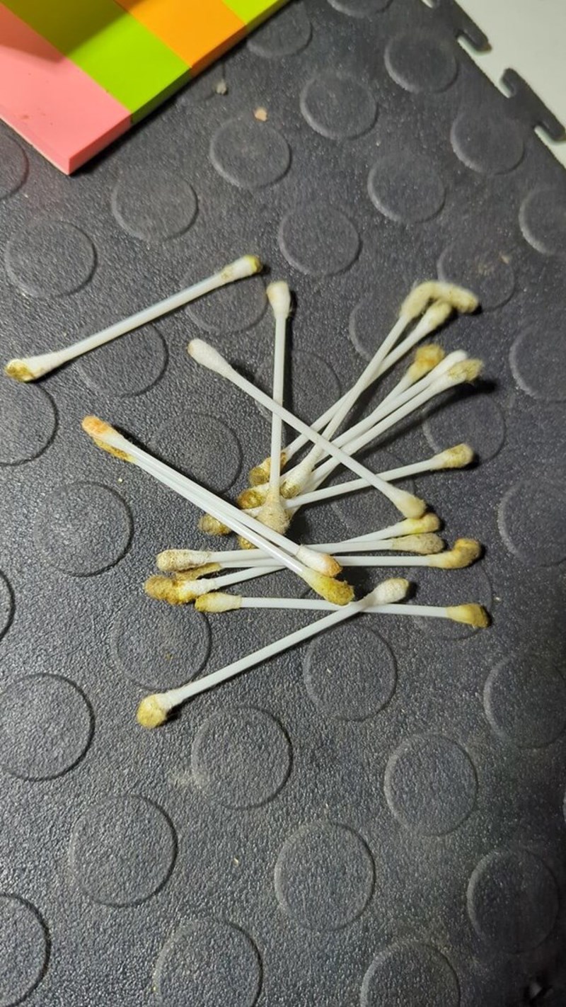 Kolega je čistio uši kraj mene na poslu