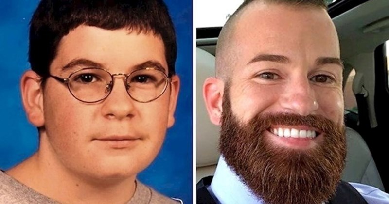 15 nevjerojatnih primjera koji pokazuju koliko se nečiji izgled može promijeniti