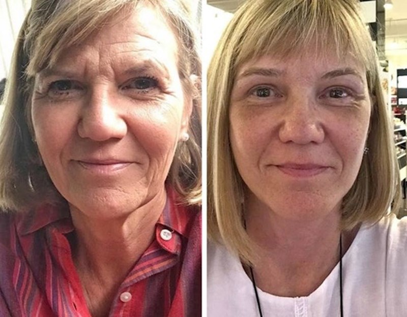 9. "Obrazi, obrve i kapci prije i sada. Izgledam barem pet godina mlađe!"