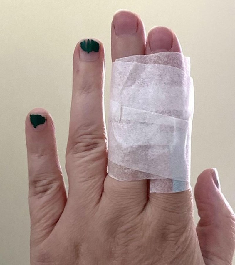 Trogodišnjak mi je nagazio na prste