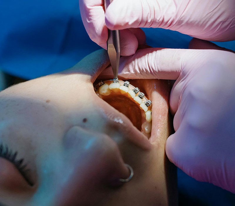 Zubar sam i ovo me često pitaju: