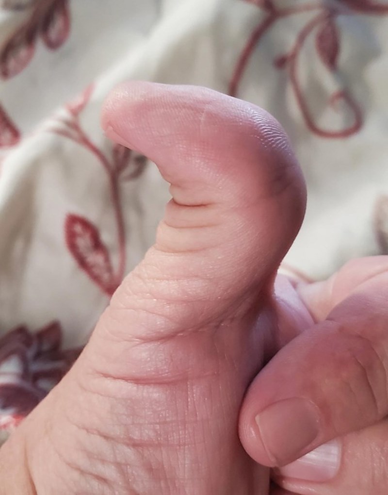 Imam palac koji mogu saviti i naprijed i natrag.