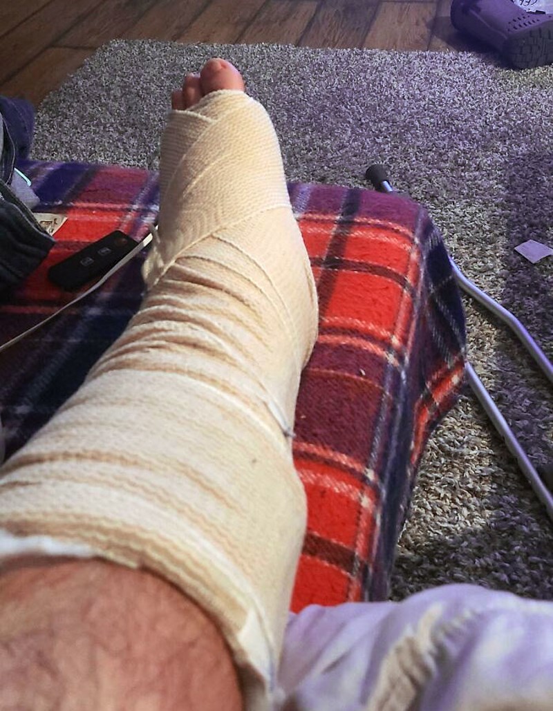 Izašao sam vani baciti petardu i poskliznuo se na led