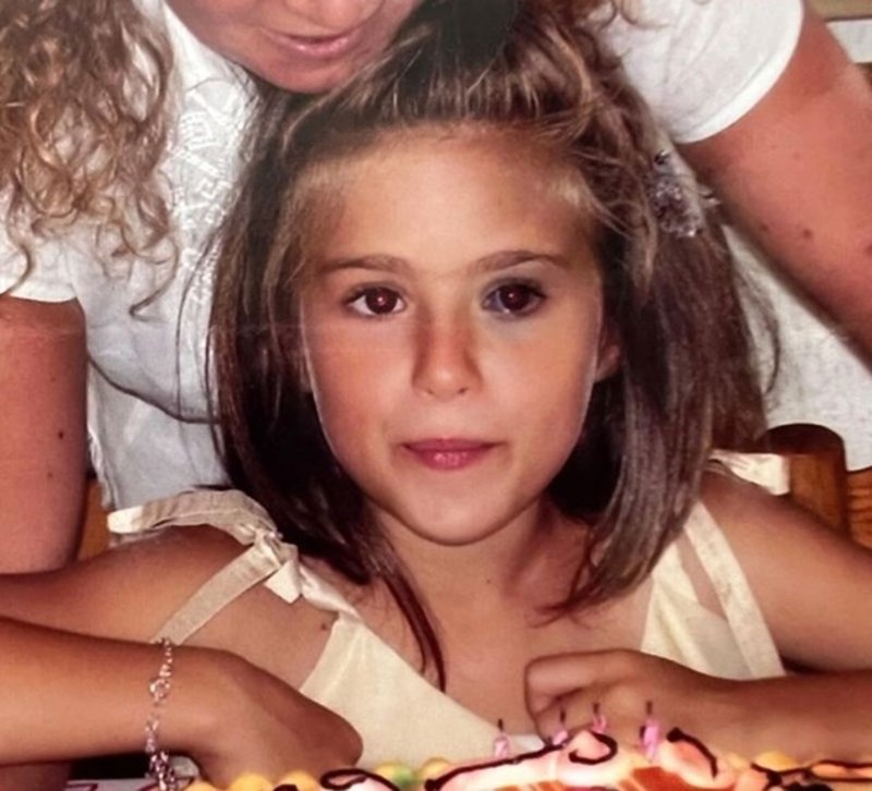 Njeno ime je Carlotta Bertotti i rođena je s rijetkim i benignim stanjem zvanim Nevus Ota. Riječ je o pigmentaciji nalik madežu koja se pojavljuje oko oka i Carlotta je od najranije dobi bila svjesna te svoje posebnosti.