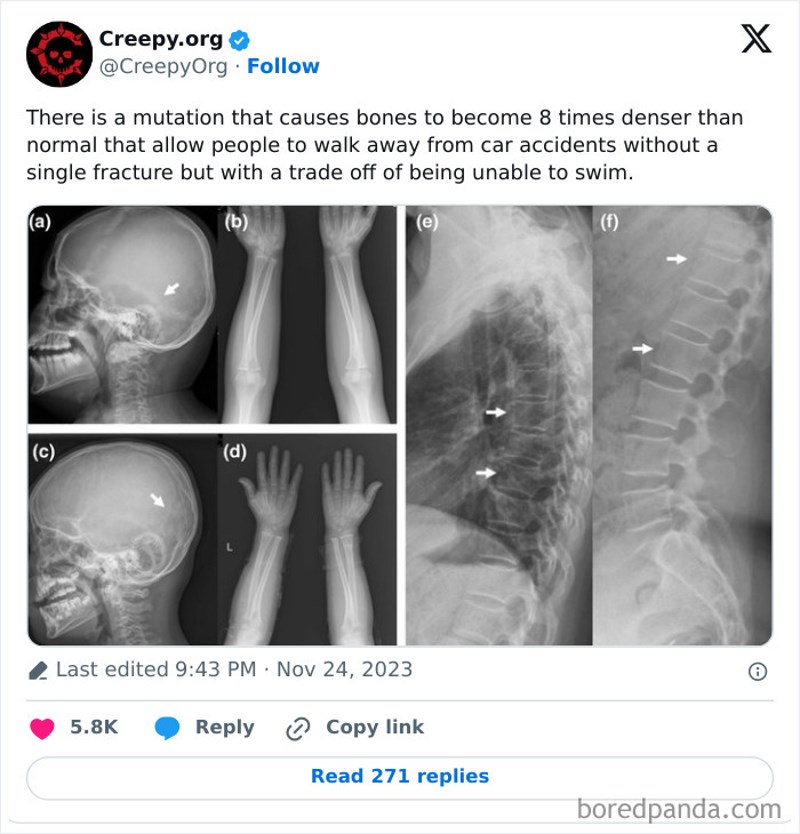 Postoje ljudi-mutanti