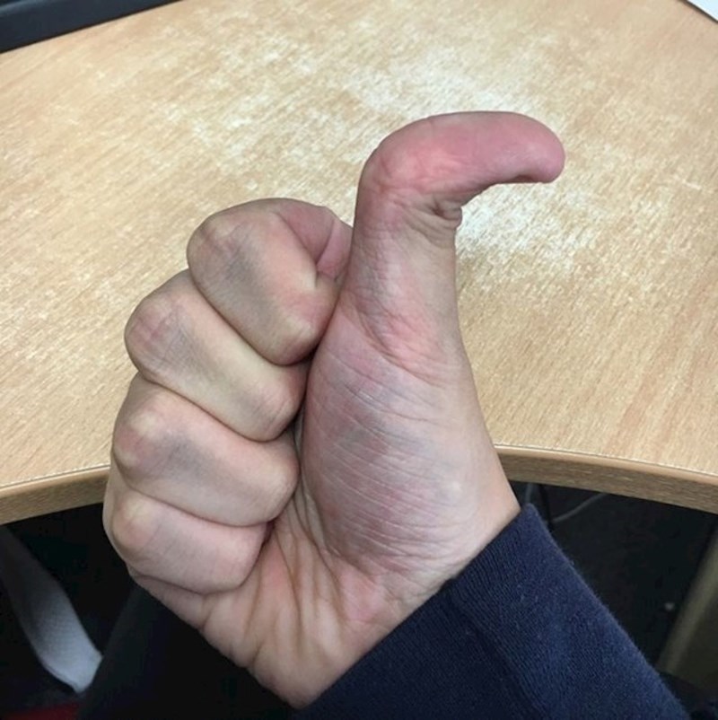 Vrlo neobičan palac