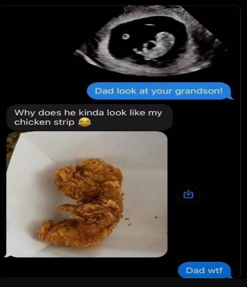 Poslala mu sliku ultrazvuka, tata kaže da izgleda kao njegov nugget